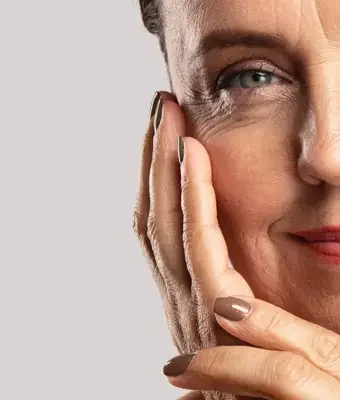 Ankara anti-aging cilt gençleştirme protokolü IDÔLET Beauty