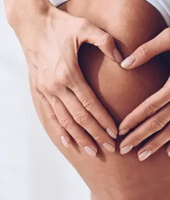 Selülit tedavisi Ankara Çankaya IDÔLET Beauty